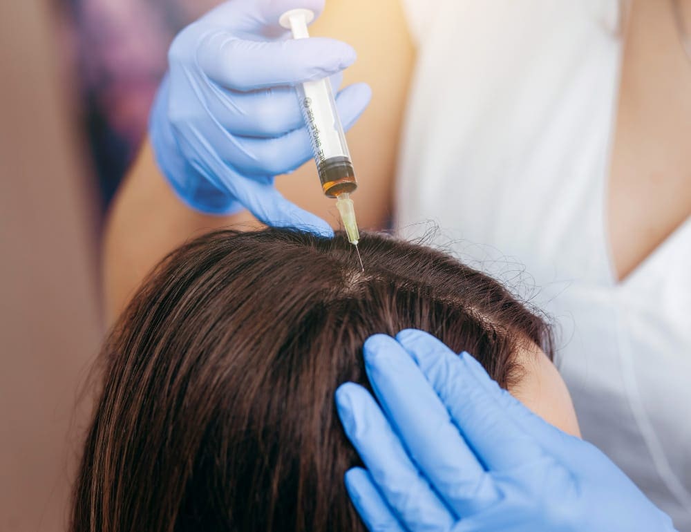 ما هو علاج ريجينيرا Regenera؟ وما هي فوائده في علاج تساقط الشعر؟