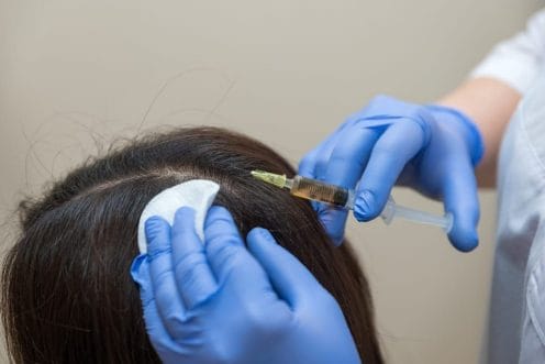 ما هو علاج ريجينيرا لتساقط الشعر؟ 